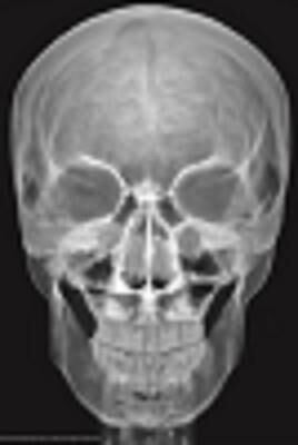 4M DENEY PARLAYAN İSKELET